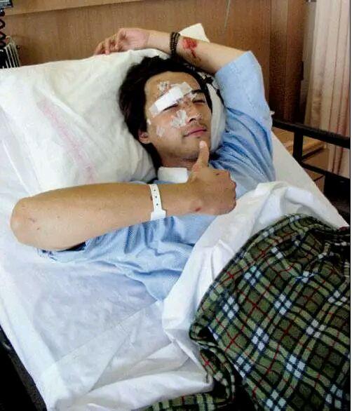 神枪手黄晓明:拍戏意外毁容又重新振作起来的明星有哪些？