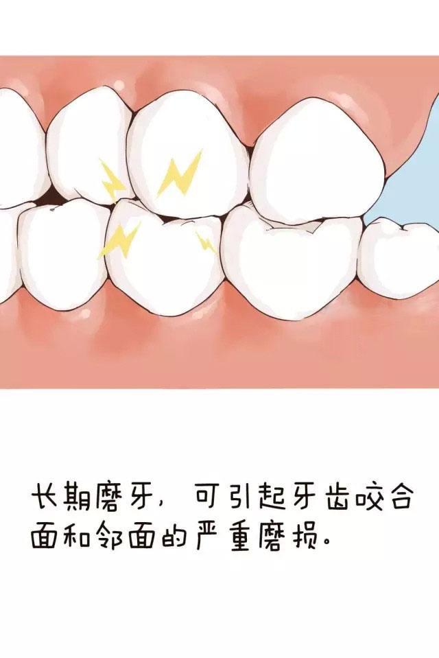 磨牙该怎么治疗