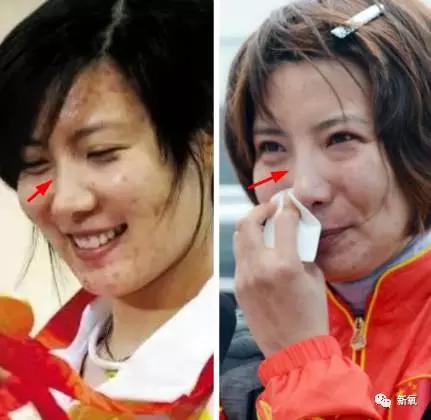 韩国明星整容失败:你们有没有见过或者听说过一些整容失败的案例？
