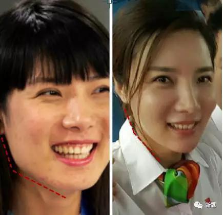 韩国明星整容失败:你们有没有见过或者听说过一些整容失败的案例？