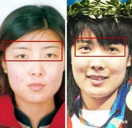 韩国明星整容失败:你们有没有见过或者听说过一些整容失败的案例？