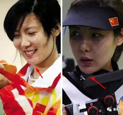 韩国明星整容失败:你们有没有见过或者听说过一些整容失败的案例？