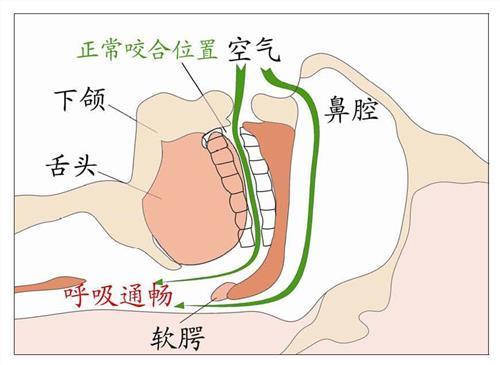 打呼噜偏方(打呼噜偏方一分钟见效)