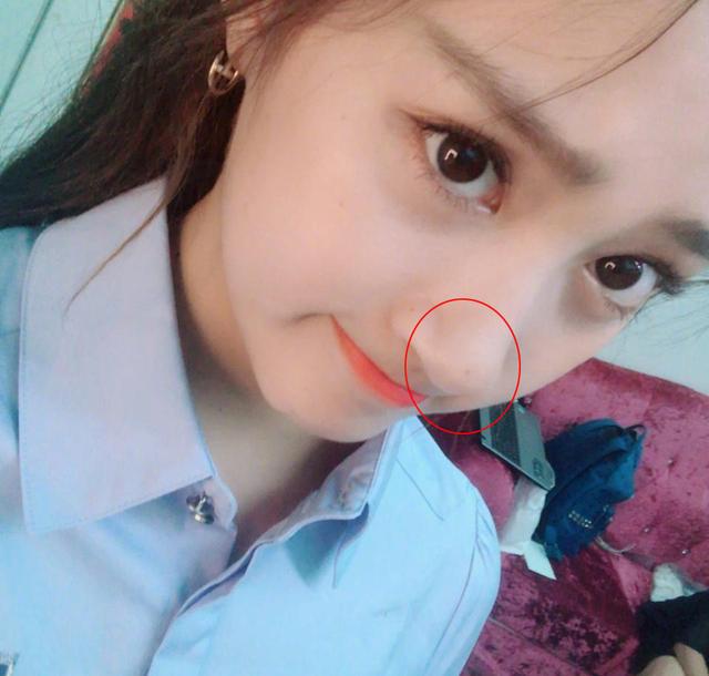 贾青整容:整容最成功的女明星是谁？