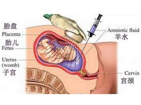 胎儿绒毛亲子鉴定:杭州市妇幼保健院可以做绒毛亲子鉴定嘛？