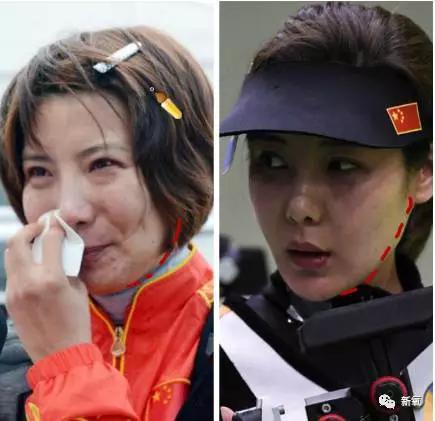 韩国明星整容失败:你们有没有见过或者听说过一些整容失败的案例？