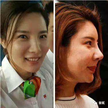 韩国明星整容失败:你们有没有见过或者听说过一些整容失败的案例？