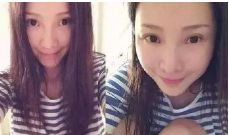张歆艺整容:哪些女明星本来很好看却要整容，还越整越丑？