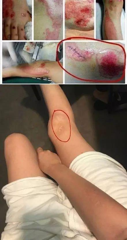 薛之谦娄艺潇:娄艺潇是不是李雨桐所说的“L女星”？她和薛之谦到底怎么回事？