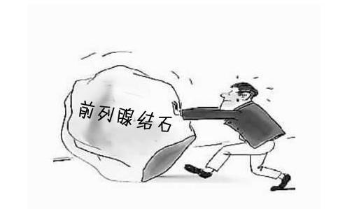 膀胱结石症状预防:肾结石或尿道结石有什么症状？