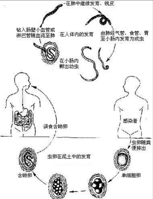 头条问答 - 蛔虫是如何导致人体患病的?(2个回答)