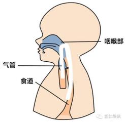 小奶狗呛肺里会怎样:婴儿呛奶很危险，呛奶发生时如何急救？ 奶狗呛到肺的症状有哪些