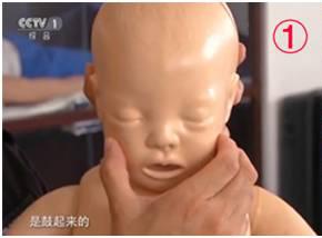 小奶狗呛肺里会怎样:婴儿呛奶很危险，呛奶发生时如何急救？ 奶狗呛到肺的症状有哪些