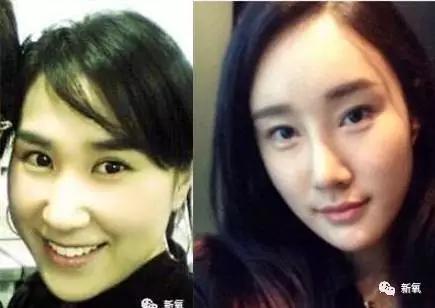 崔始源的妹妹:整容上瘾或者过度整容会对人有什么影响？