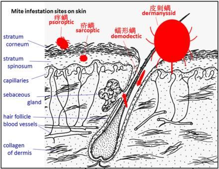 螨虫感染:人一般会感染3种螨虫，是哪3种？