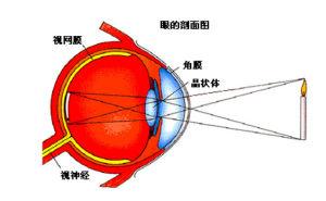 先天性近视能治好吗,儿童得了真性近视还能治好吗？