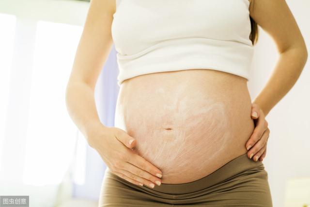 如何预防妊娠纹:如何预防妊娠纹最有效的方法
