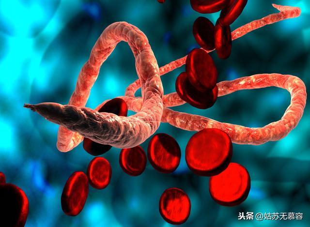 埃博拉病毒病人图片,刚果爆发了新一轮埃博拉疫情，和新冠肺炎相比，埃博拉严重吗？