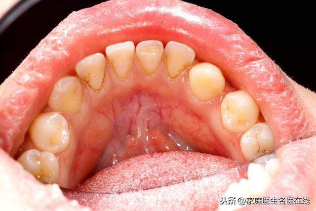 口腔疾病有哪些，口腔有哪些常见的问题会困扰人们的生活？