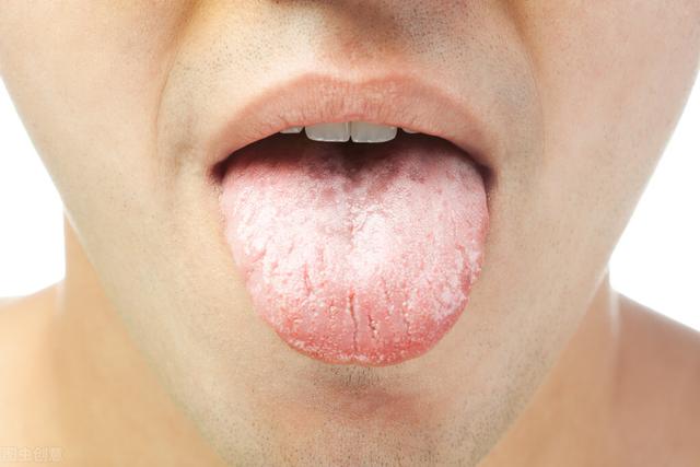 舌苔厚也是脾虚吗，舌头厚白，有齿痕，大便稀，是什么原因？能调理好吗？