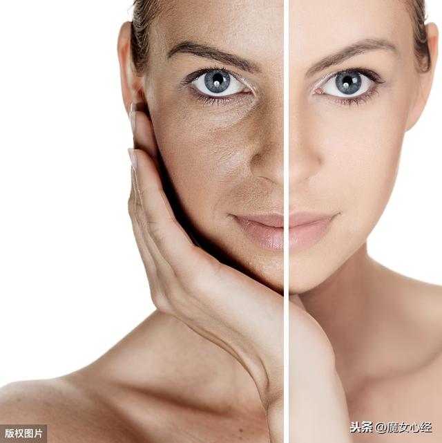 皮肤极差的人如何从头开始恢复健康皮肤？