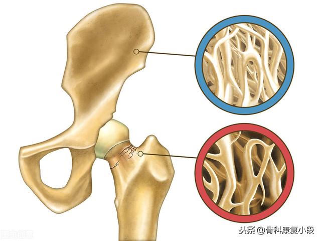 风来客燕麦骨:中年人如何增强自己的骨密度？