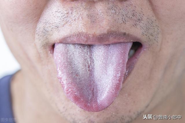 舌苔厚也是脾虚吗，经常牙齿发黄，口臭，舌苔厚，是什么原因？
