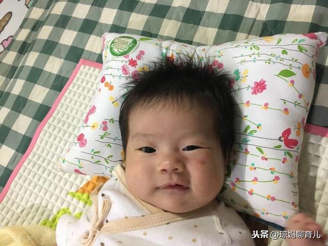 小宝宝为什么会出现枕秃，奶粉喂养的九个月宝宝后脑勺头发稀少，是缺钙了吗