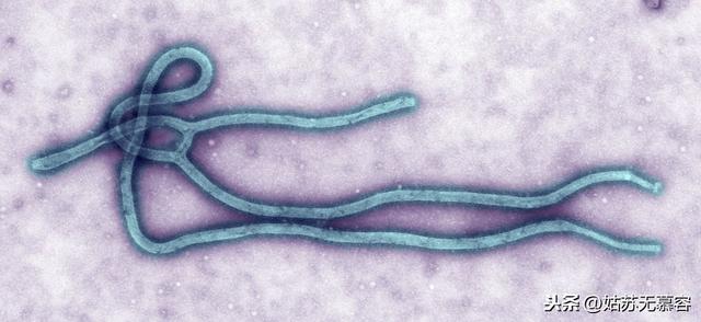 埃博拉病毒病人图片,刚果爆发了新一轮埃博拉疫情，和新冠肺炎相比，埃博拉严重吗？