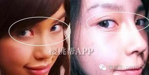 哪个明星没整过容:Angelababy到底整容没？