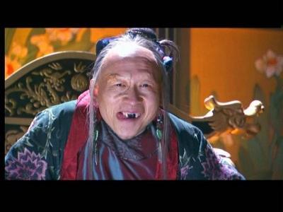 孟非受伤:为什么秃顶的这么多，却很少有人做植发