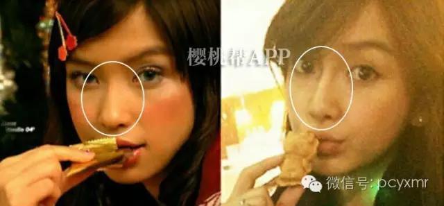 哪个明星没整过容:Angelababy到底整容没？