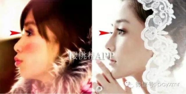 哪个明星没整过容:Angelababy到底整容没？
