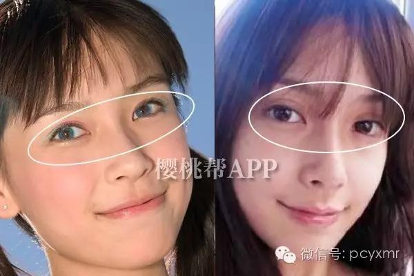 哪个明星没整过容:Angelababy到底整容没？