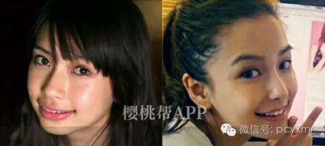 哪个明星没整过容:Angelababy到底整容没？