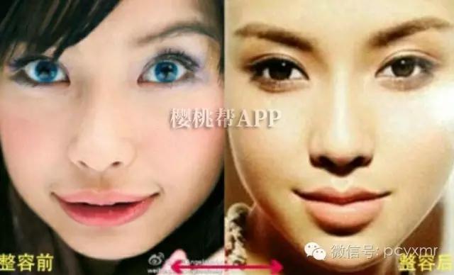 哪个明星没整过容:Angelababy到底整容没？