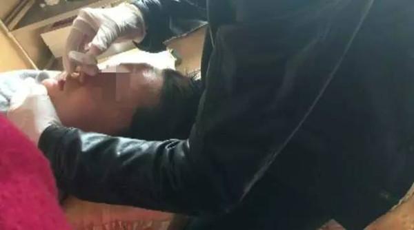 凤姐整容后照片老公:明明知道国内微整形是骗局为什么还是有这么多上当
