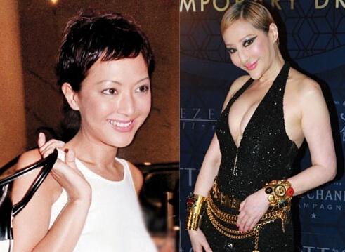 孙菲菲整容失败:女神整容成网红，或者整容失败的女星有哪些