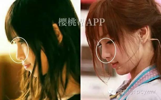 哪个明星没整过容:Angelababy到底整容没？