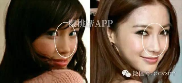 哪个明星没整过容:Angelababy到底整容没？