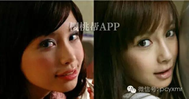 哪个明星没整过容:Angelababy到底整容没？
