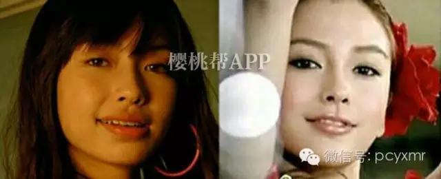 哪个明星没整过容:Angelababy到底整容没？