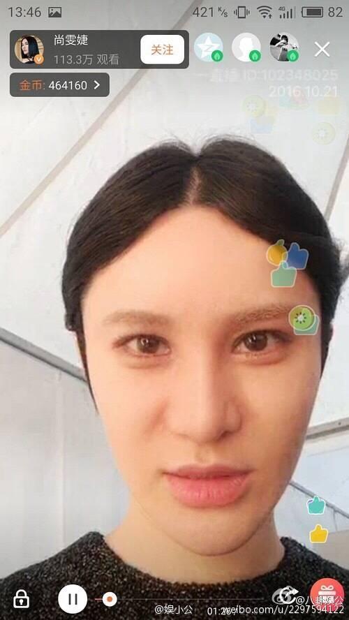 孙菲菲整容失败:女神整容成网红，或者整容失败的女星有哪些