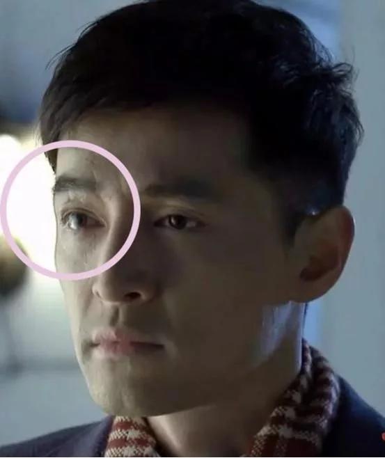 任家萱烧伤图片:范玮琪摔伤下巴缝了15针，如何看待明星网上晒受伤的行为