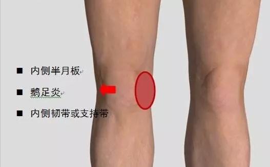 膝盖内侧副韧带撕裂一年能恢复吗要注意什么