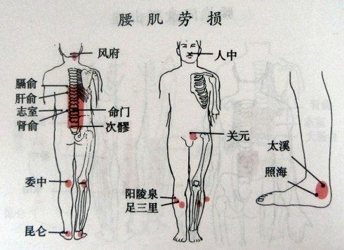 腰肌劳损位置图图片