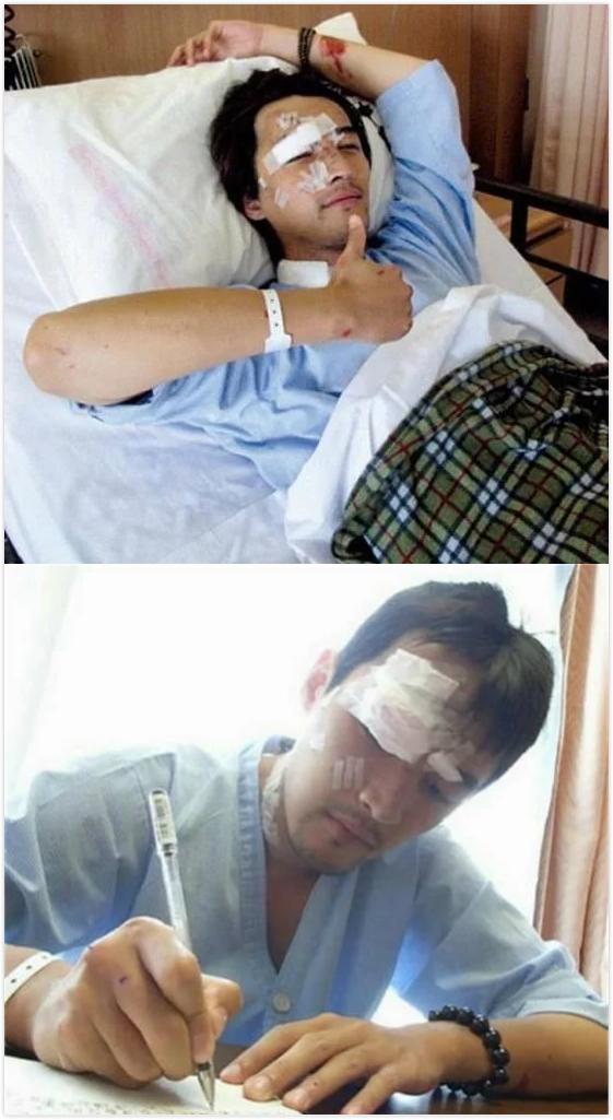 任家萱烧伤图片:范玮琪摔伤下巴缝了15针，如何看待明星网上晒受伤的行为