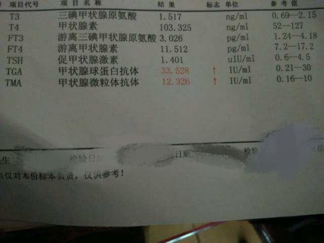 大脖子病症状(大脖子病症状怎么引起)