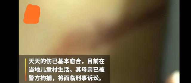 易遥的孩子是谁的:7岁男童遭亲妈家暴，但依然希望待在妈妈身边，你怎么看