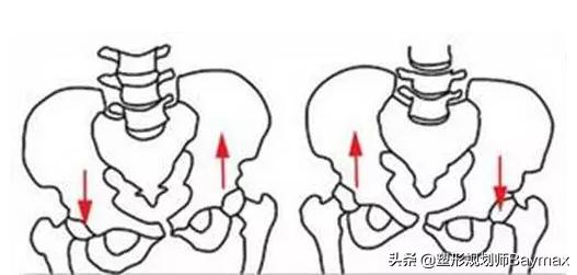 造成身长腿短的原因:长短腿形成的原因，如何改善？